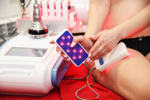 Laser Lipo 3